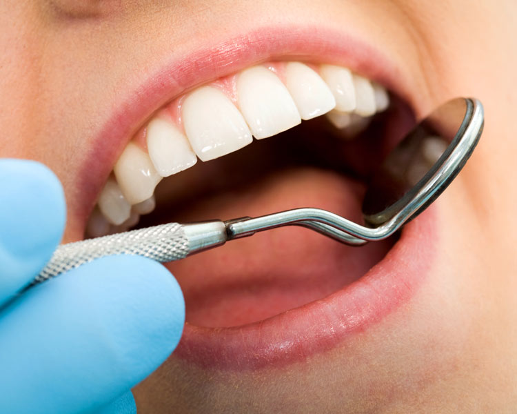 dental hygiene white teeth
