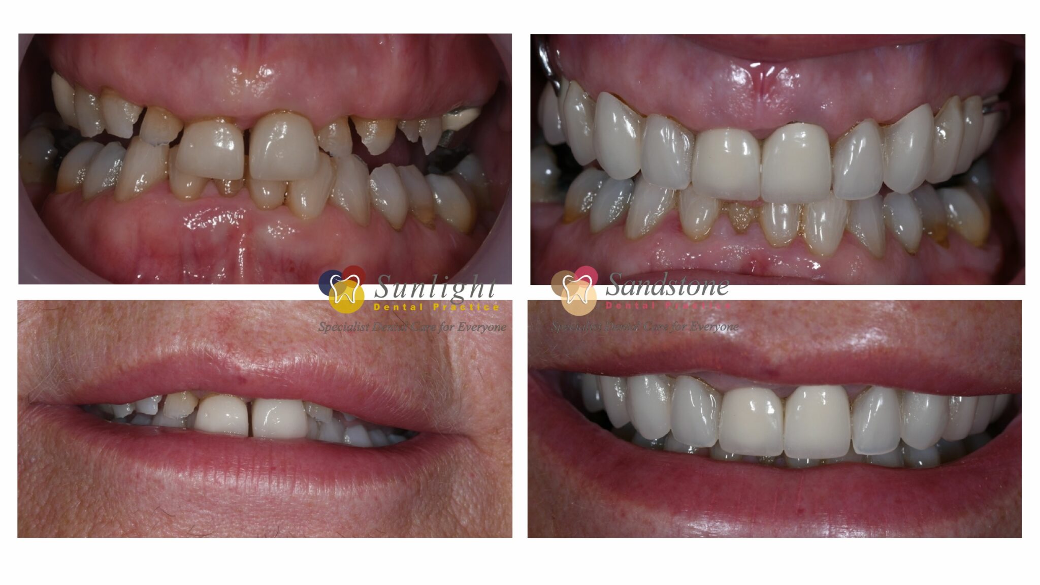 Sandstone Dental Practice Case Study Susan The Sandstone Dental